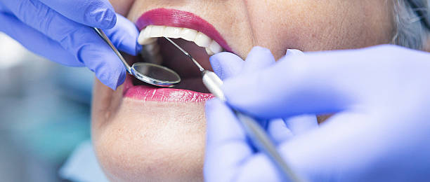 Best Emergency Denture Repair in La Pine, OR